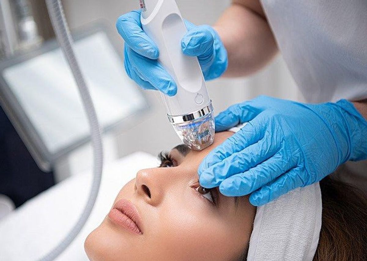 Thủ thuật RF vi điểm 