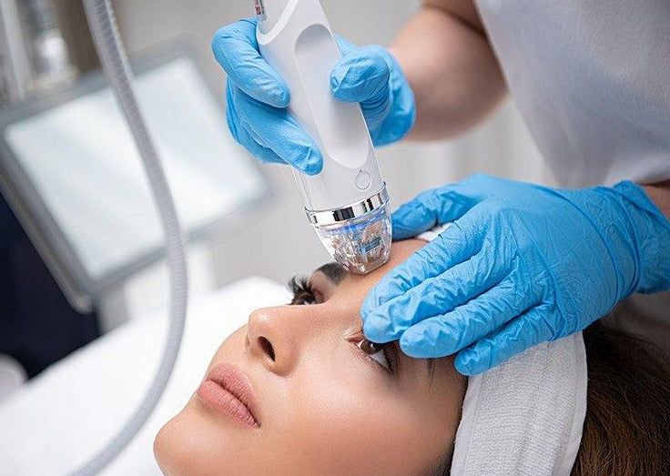 Thủ thuật RF vi điểm