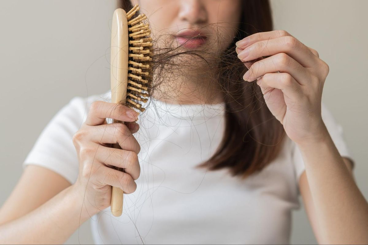 Rụng tóc do rối lọa nội tiết 