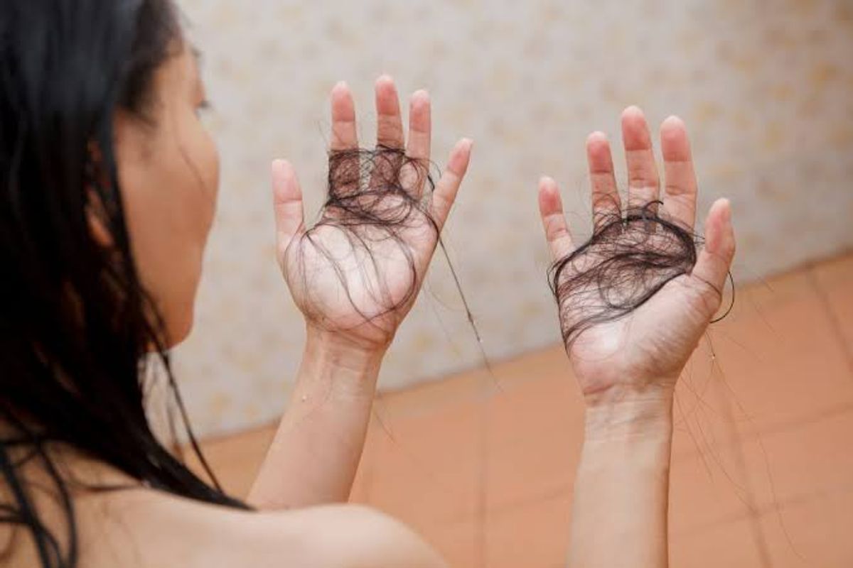 Vuốt nhẹ sau khi gội đầu cũng rụng nhiều tóc 