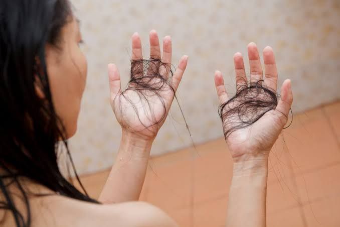 Vuốt nhẹ sau khi gội đầu cũng rụng nhiều tóc