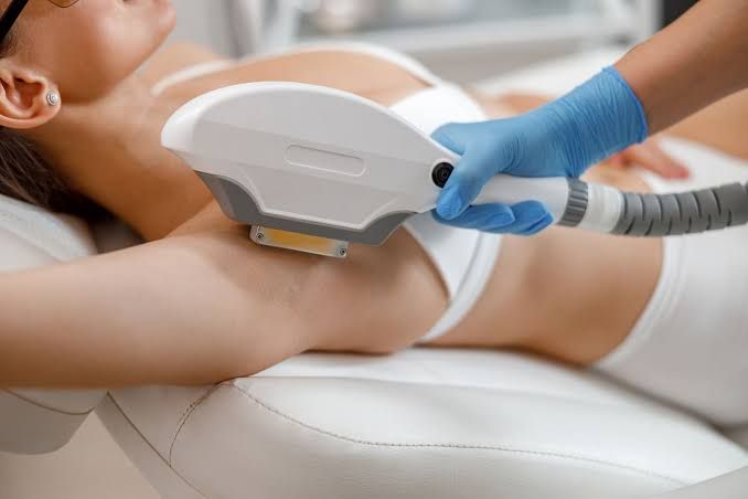 Triệt lông nách bằng công nghệ hiện đại