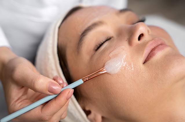 Peel da điều trị mụn 