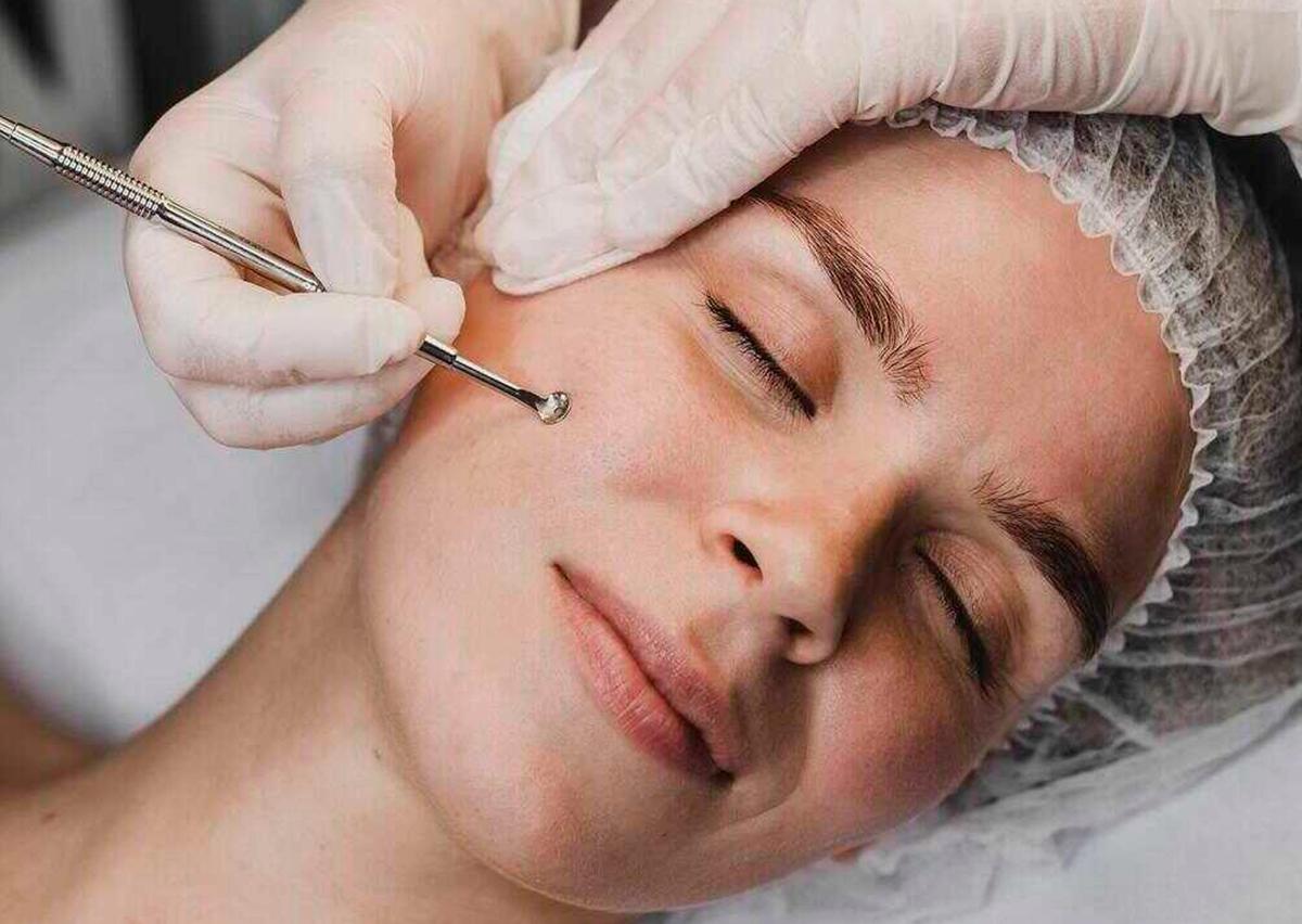 Điều trị mụn ẩn bao lâu sẽ hết 