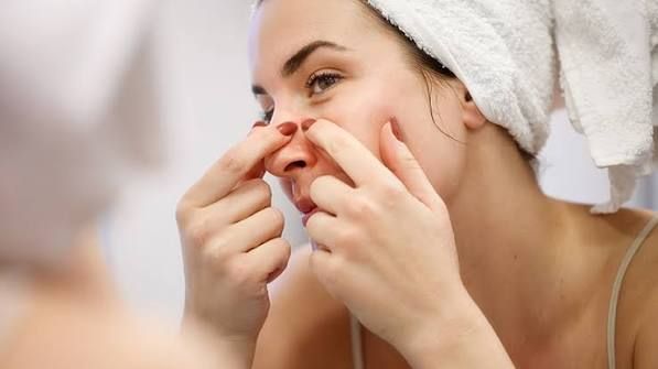 Tự nặn mụn tại nhà thay vì lấy nhân mụn chuẩn y khoa tại phòng khám