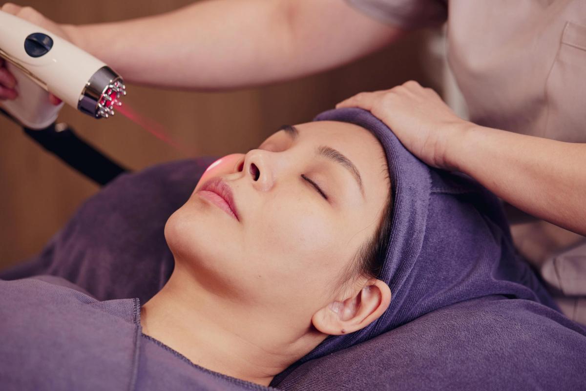 Điều trị sẹo mụn bằng laser 