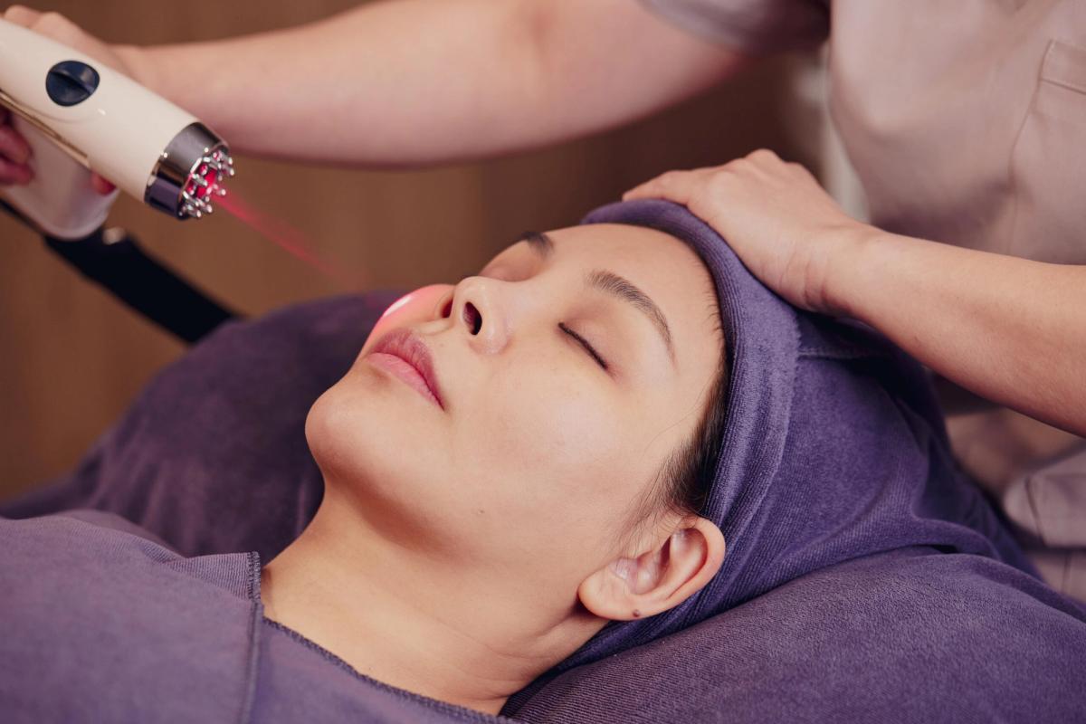 Điều trị sẹo mụn bằng laser