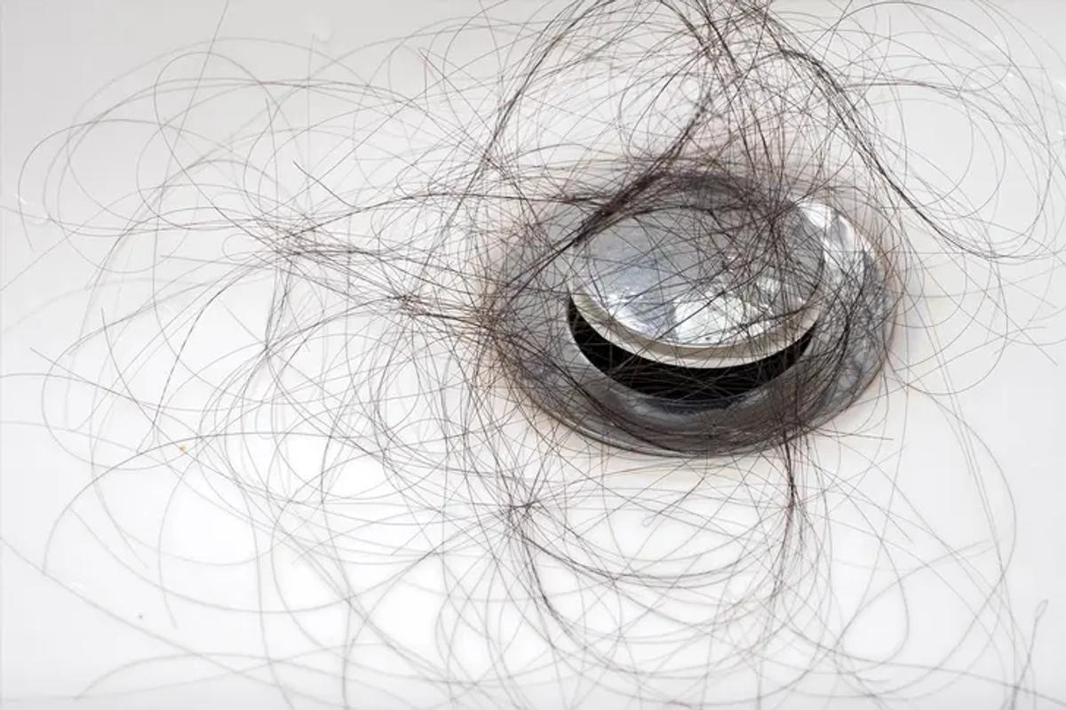 Tóc rụng do thiếu kẽm sau mỗi lần chải đầu 