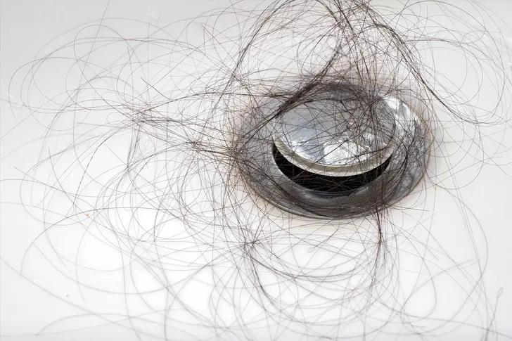 Tóc rụng do thiếu kẽm sau mỗi lần chải đầu