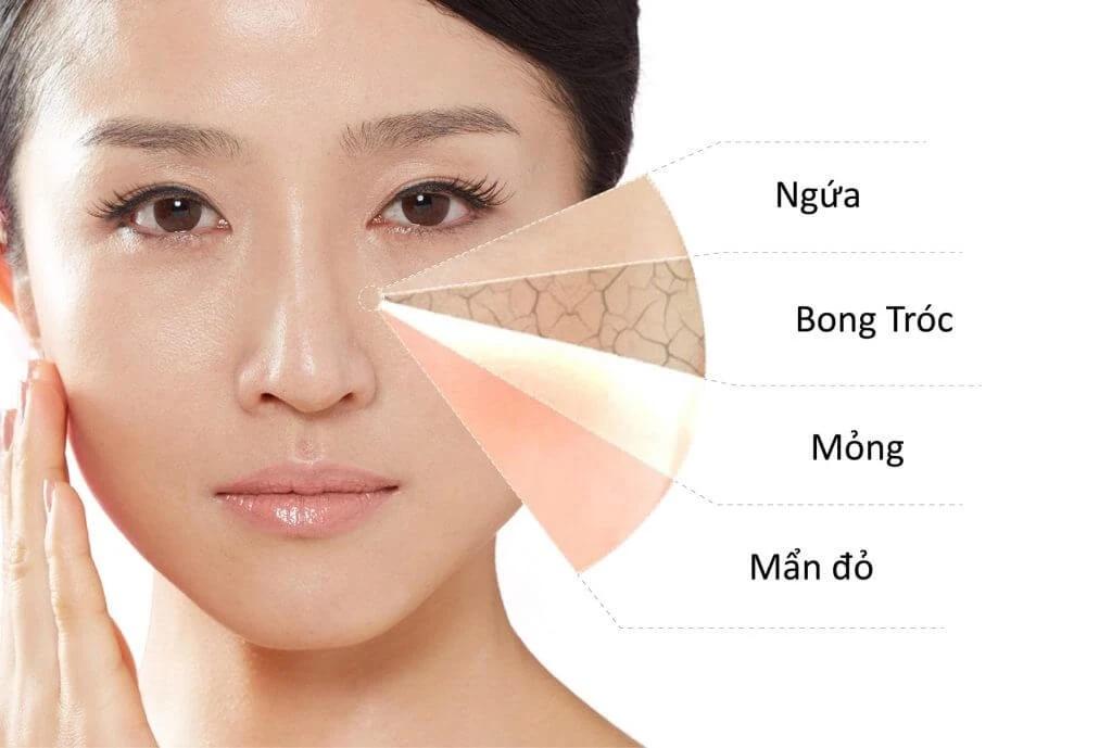 Hàng rào bảo vệ da là một yếu tố quyết định làn da có khoẻ mạnh hay không