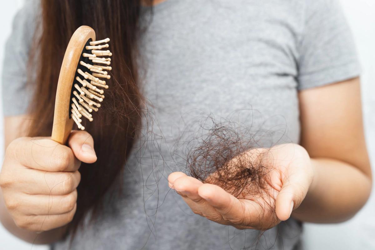 Rụng tóc nhiều sau mỗi lần chải tóc