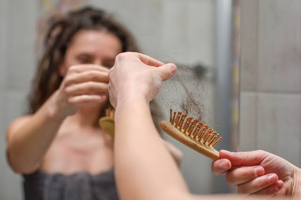 Rụng tóc do stress khiến tóc rụng nhiều 