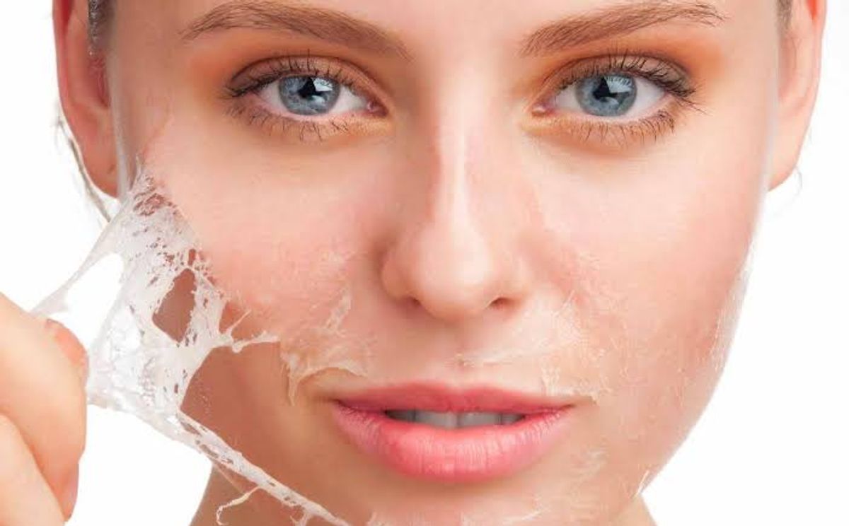 Da bong dần sau khi điều trị sử dụng phương pháp peel da 