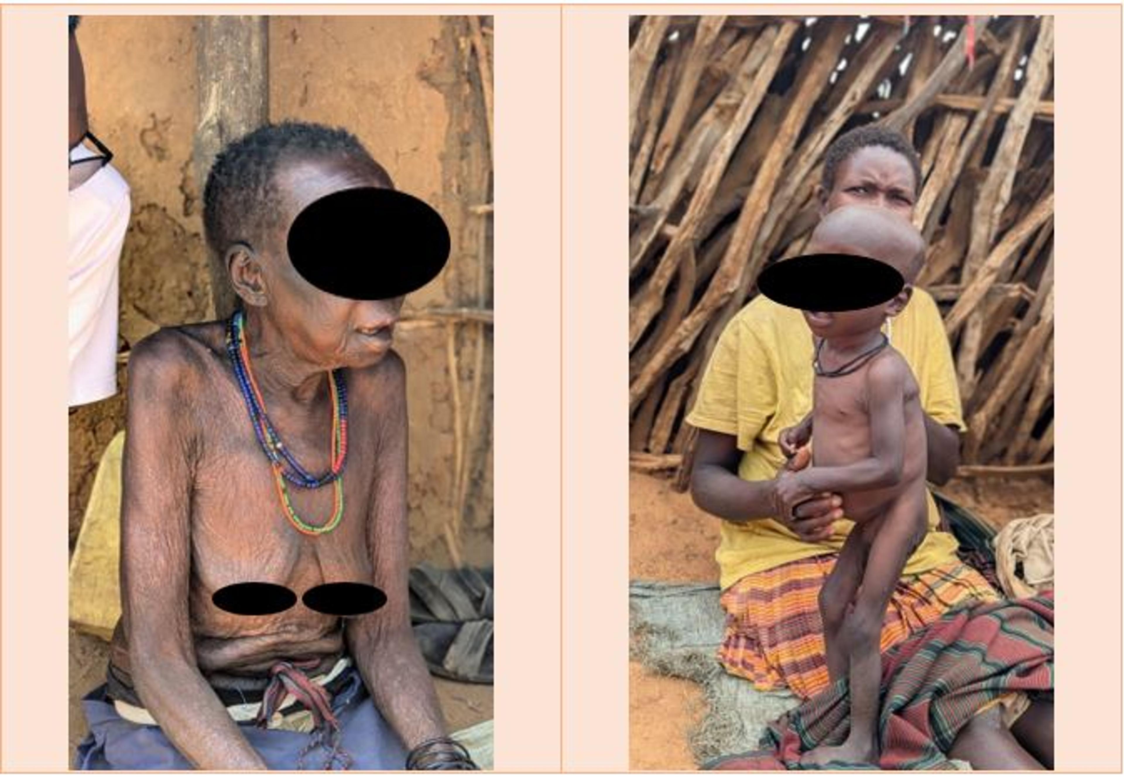 In Kotido, hunger is now killing faster than any drought before it
