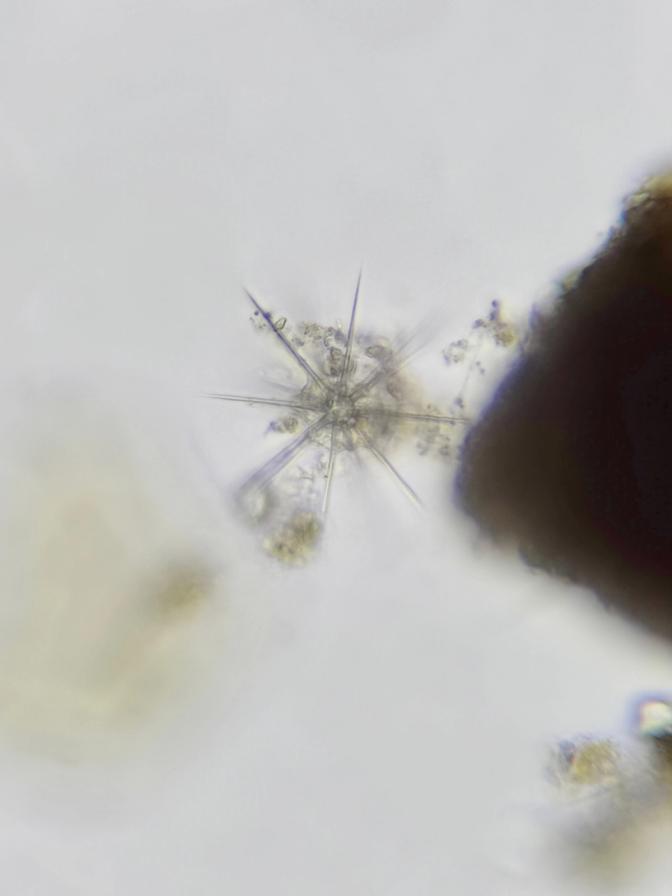 A micrograph of an Acantharia cell