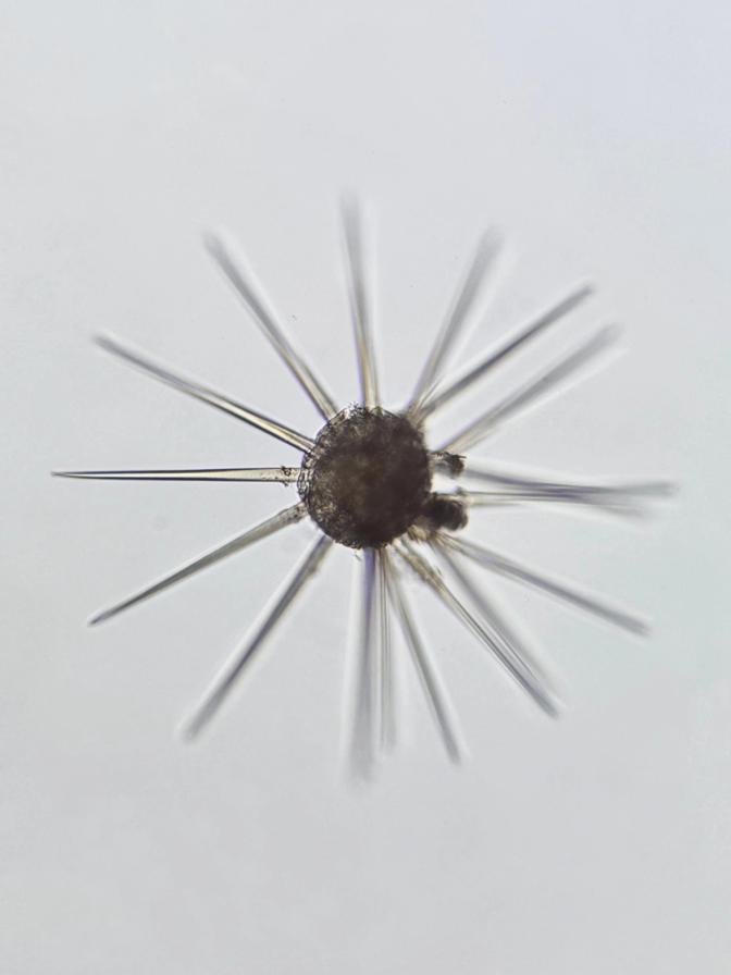 A micrograph of an Acantharia cell