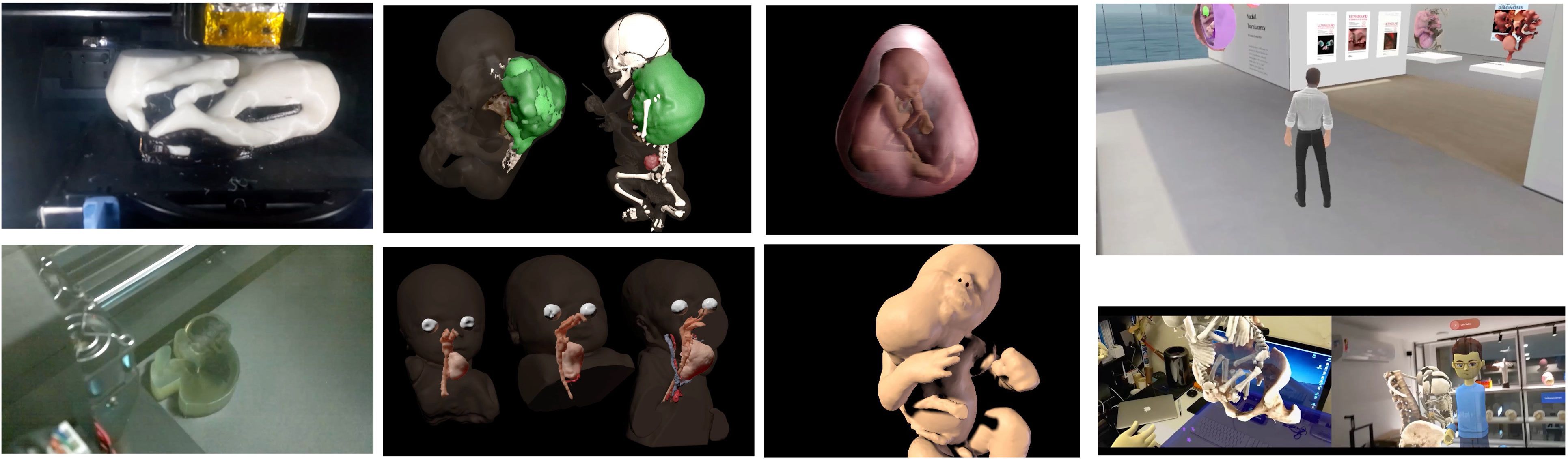 Digital twin models. Simulation and planning files for complex procedures.