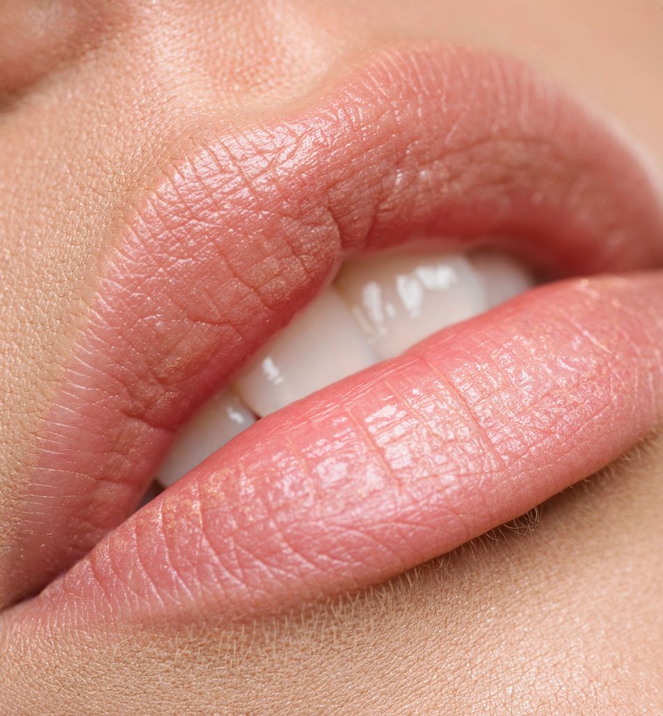 Lip Enhancement