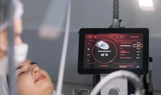 Мікроголковий Secret RF: Ефективне омолодження шкіри