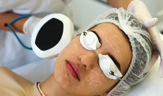 Фототерапія IPL Triton InMode: покращення стану шкіри та боротьба з пігментацією