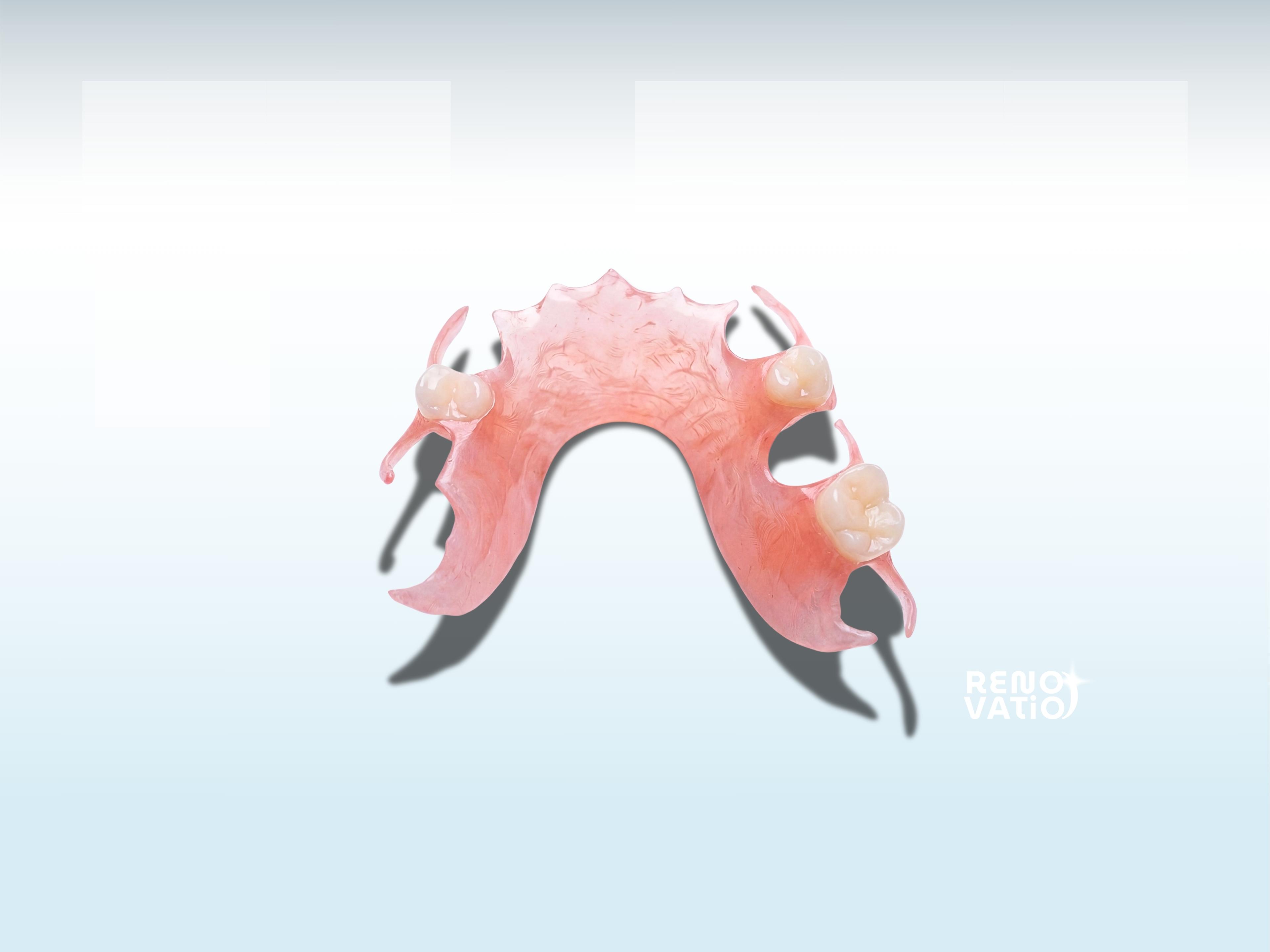 Pink partial denture with artificial teeth.