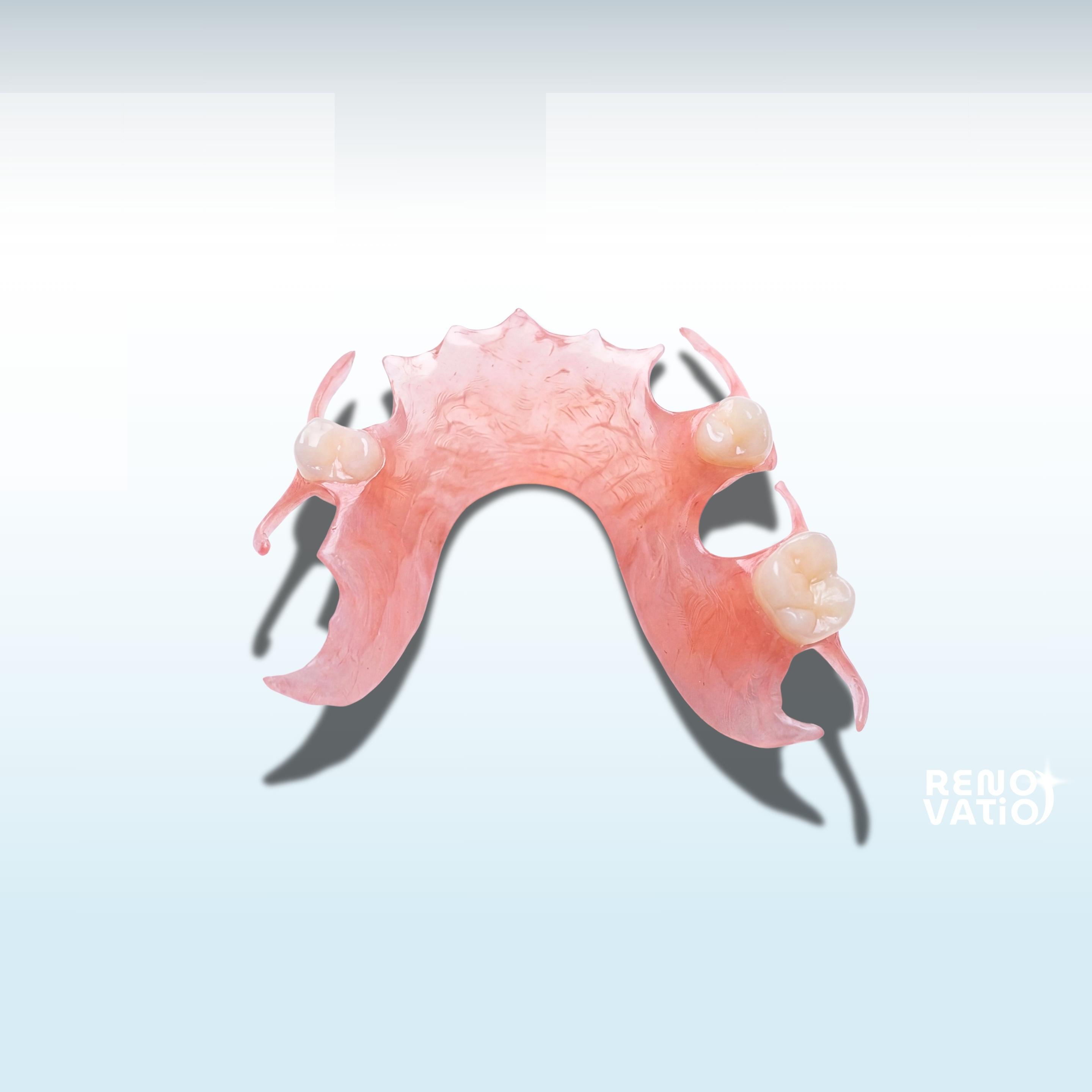 Pink partial denture with artificial teeth.