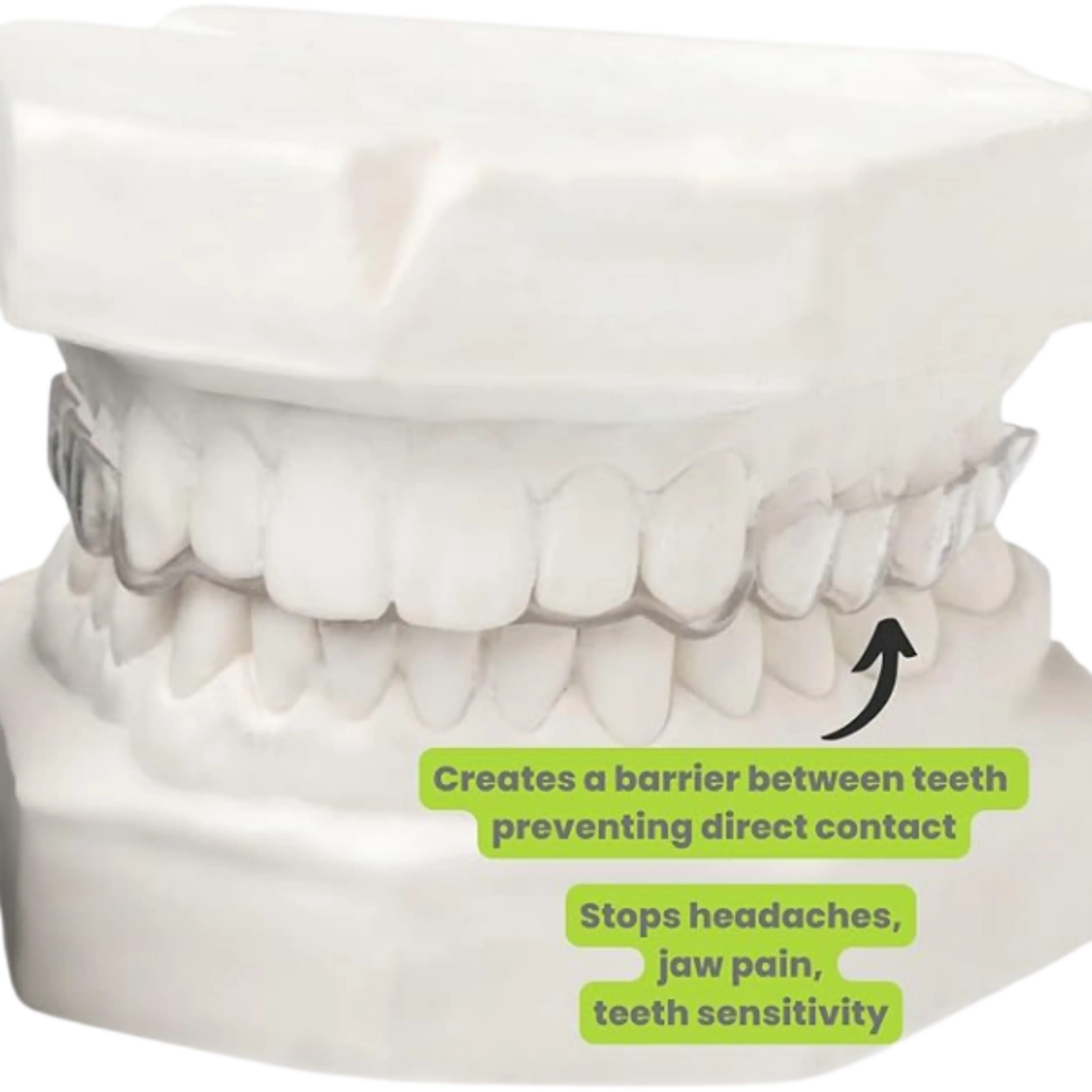 The No-Show Day Mouth Guard