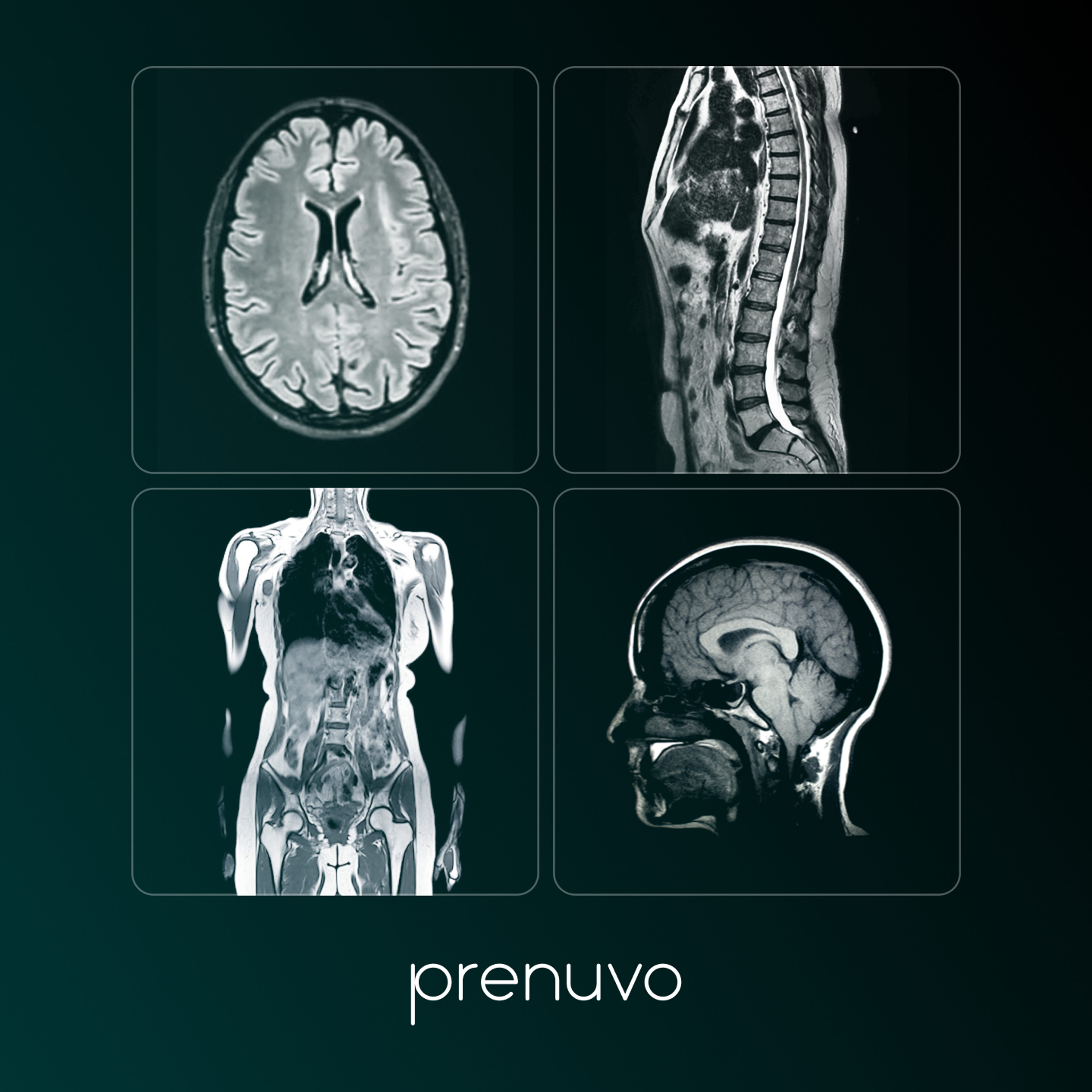 Prenuvo