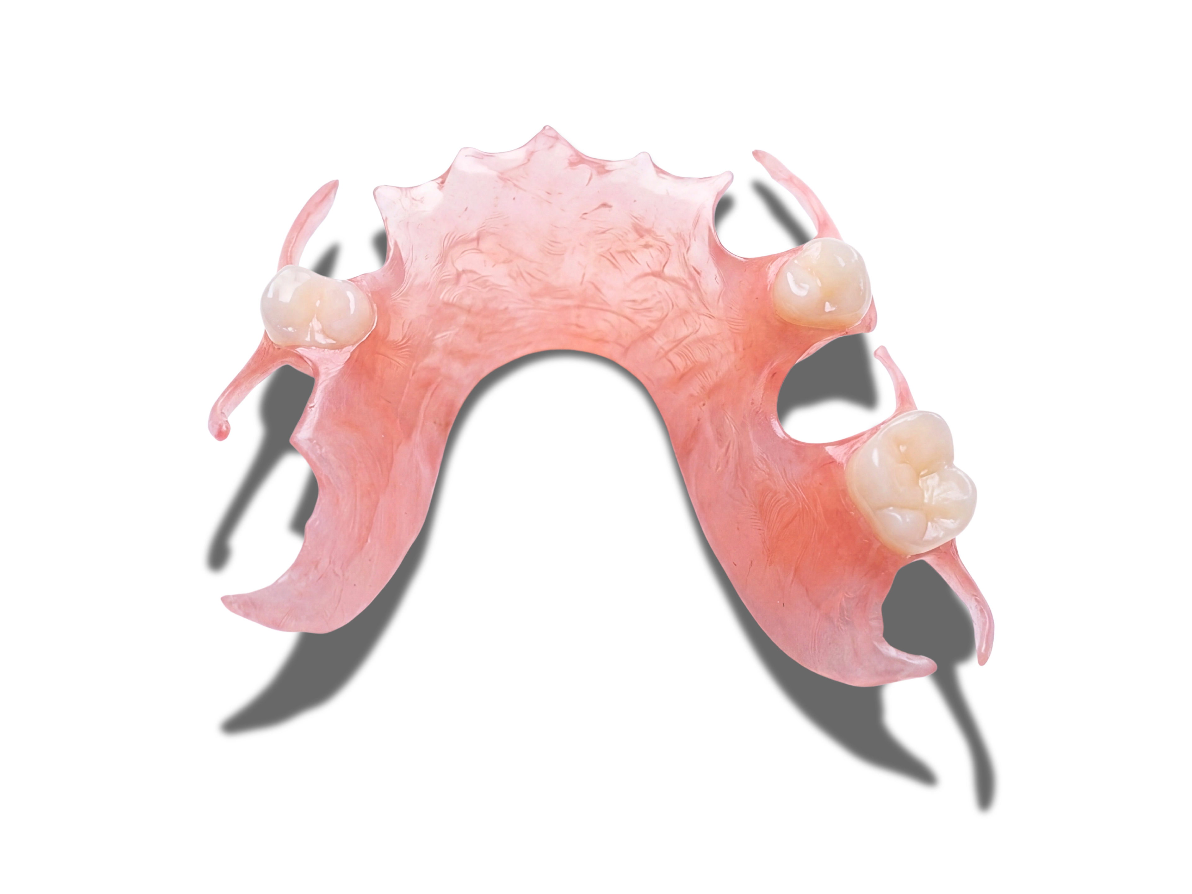 Flexible Partial Denture