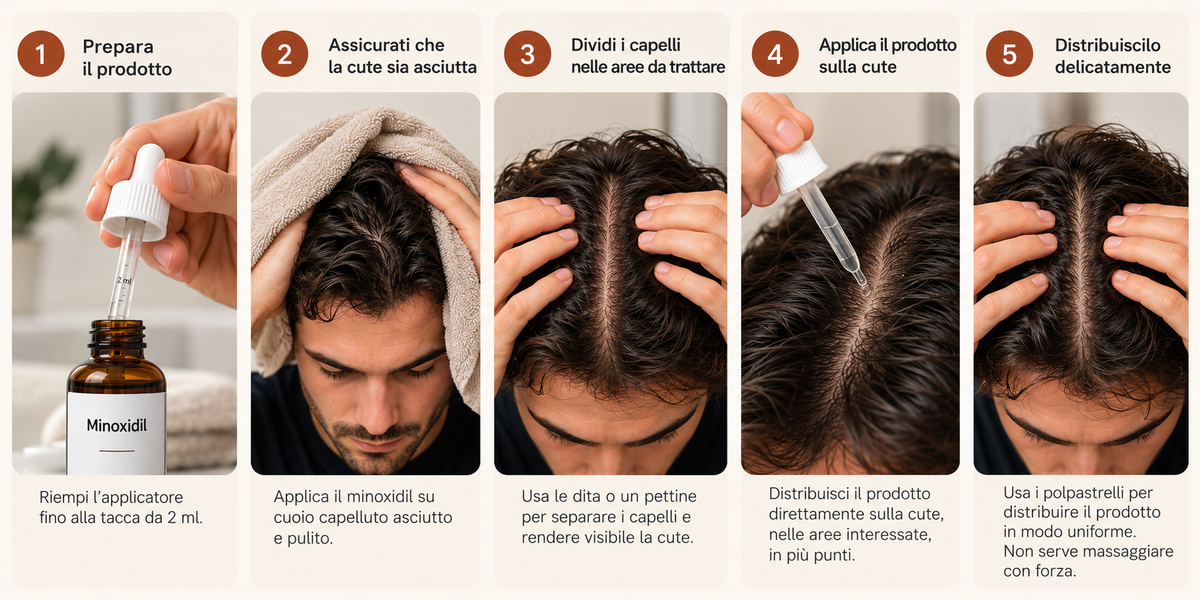 guida applicazione minoxidil