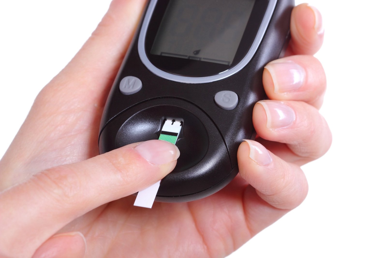 Cirugía bariátrica y diabetes tipo 2: qué significa alcanzar la remisión