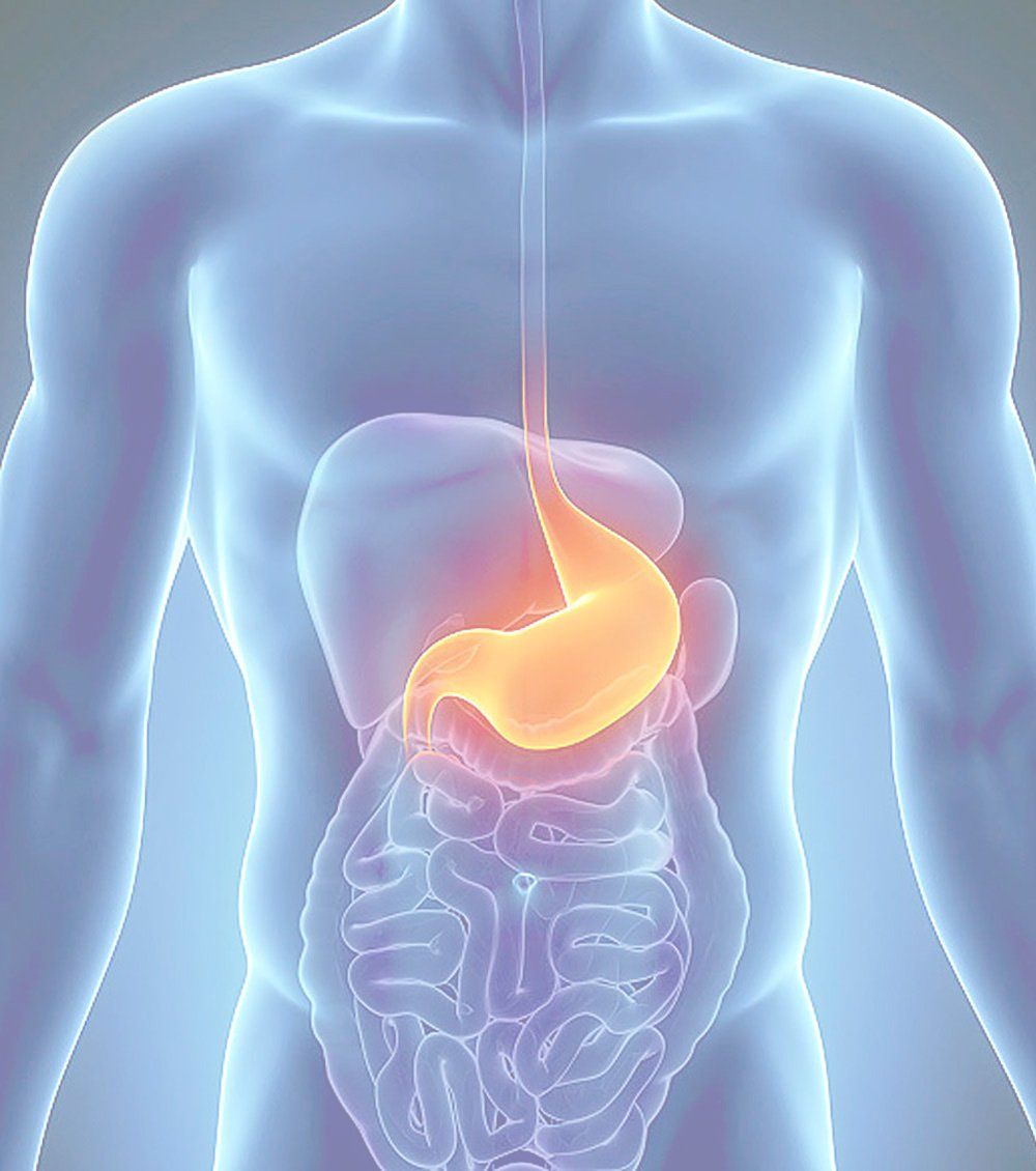 Cirugía de Hernia Hiatal
