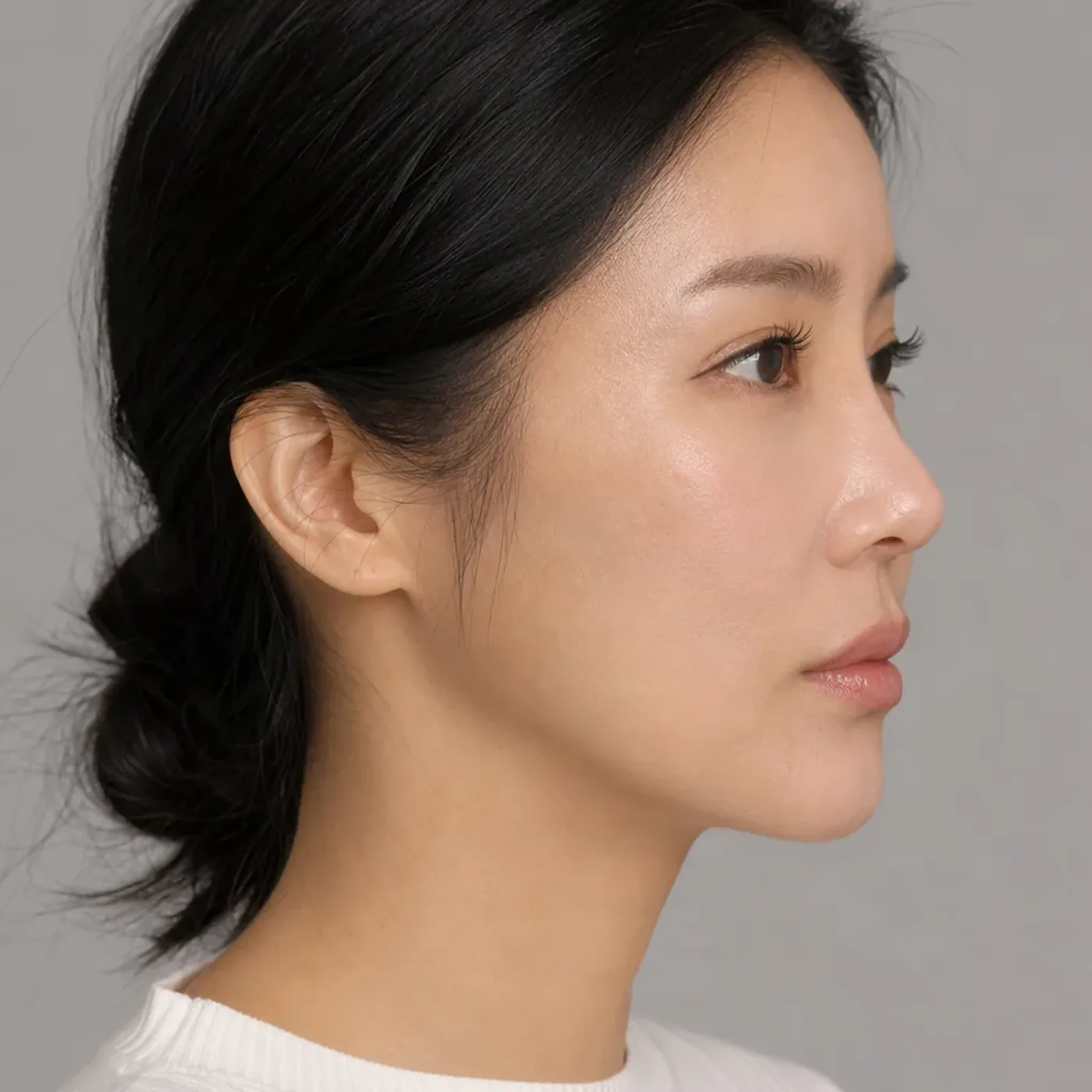 collagen stimulator before and after