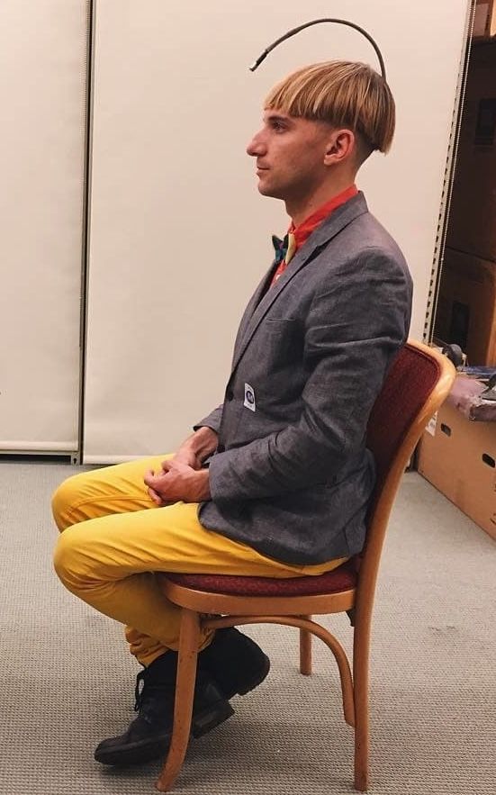 Neil Harbisson with antenna visible extending from his skull