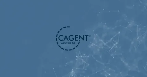 Cagent Vascular Closes $41M Series D to Advance Its New IVL System