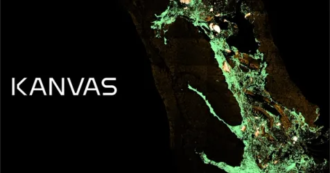 Kanvas Biosciences Secures $48M to Advance Microbiome Cancer Therapy