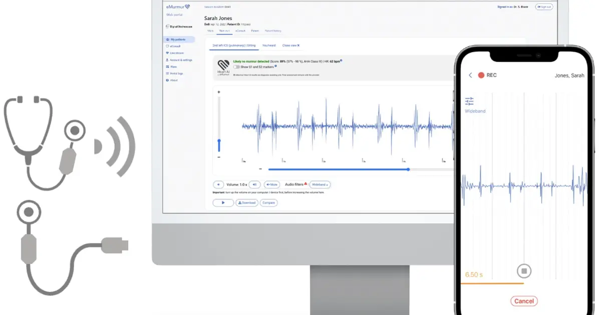 eMurmur won FDA clearance for Heart AI
