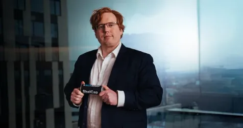 Skeleton Technologies Raises €33M for AI Data Center Power Solutions