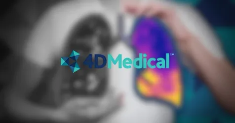 4DMedical Secures CE Mark and $57M for European Expansion