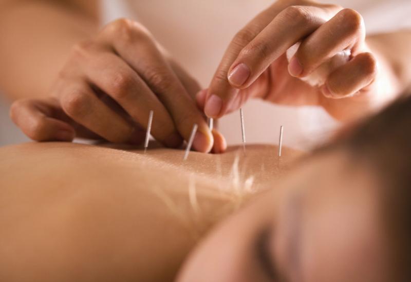 Acupuncture Services*