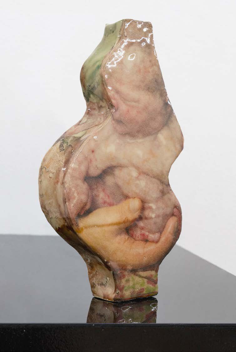 Tokophobia, image 2