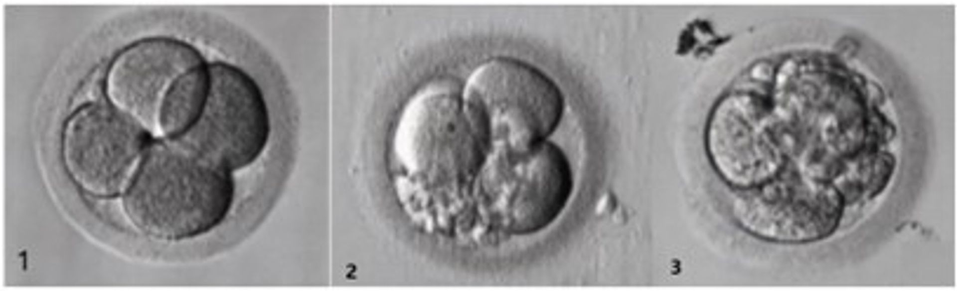 How Are Embryos Graded? Quality & Stages of Development | Adora Fertility
