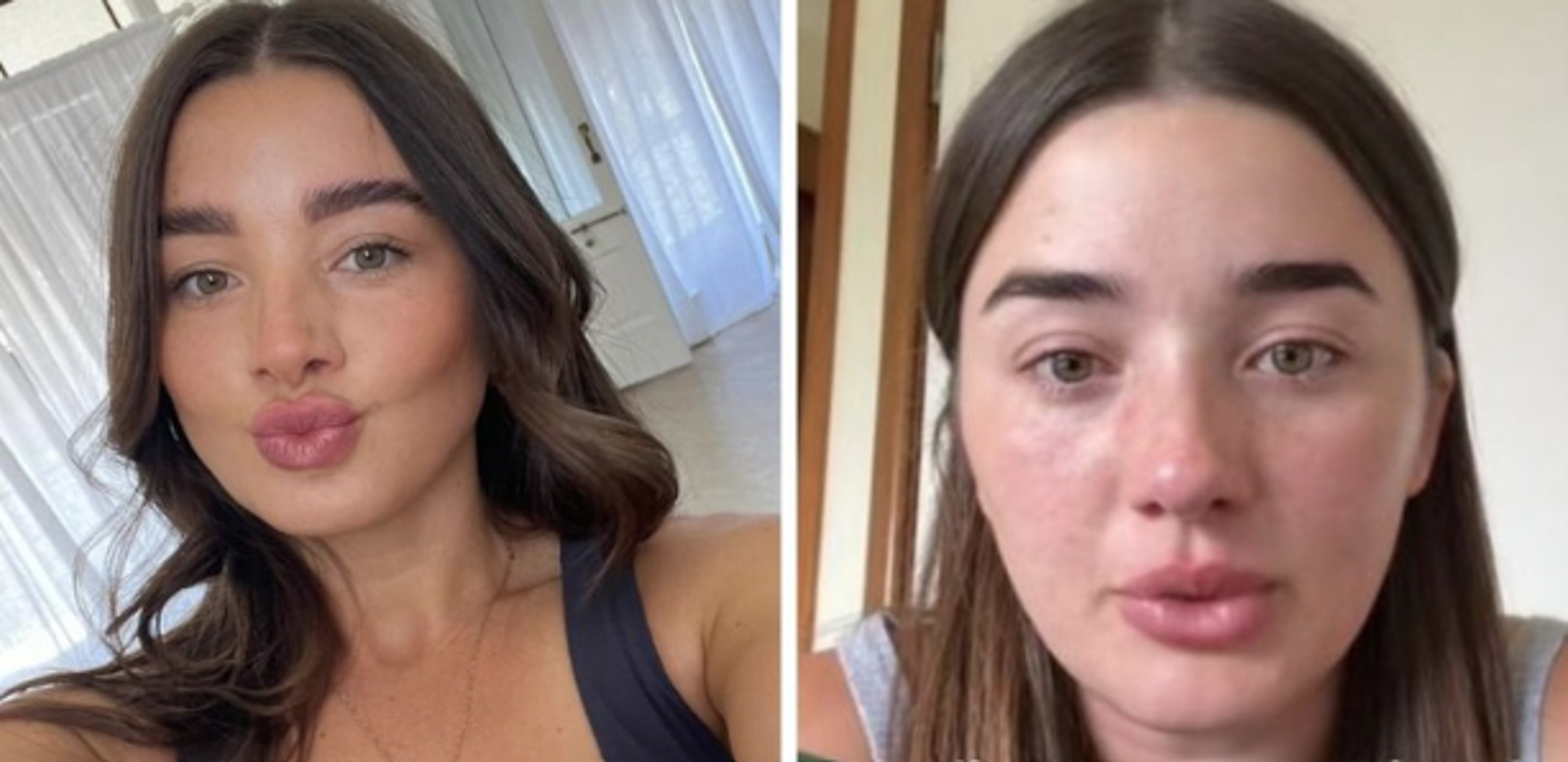 22yo student in tears over $12k medical bill only Aussie women cop