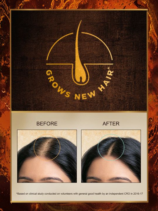 indulekha Bringha Hair Oil with Amla & Almond to Reduce Hair Fall & Grow New Hair - 2