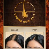 indulekha Bringha Hair Oil with Amla & Almond to Reduce Hair Fall & Grow New Hair - 2