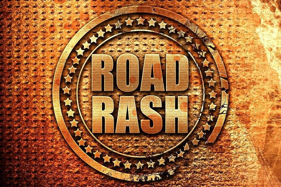 www.aceyourcase.com_blog_what-to-do-when-road-rash-occurs_-what-to-do-when-another-drivers-carelessness-leaves-me-with-road-rash.jpg