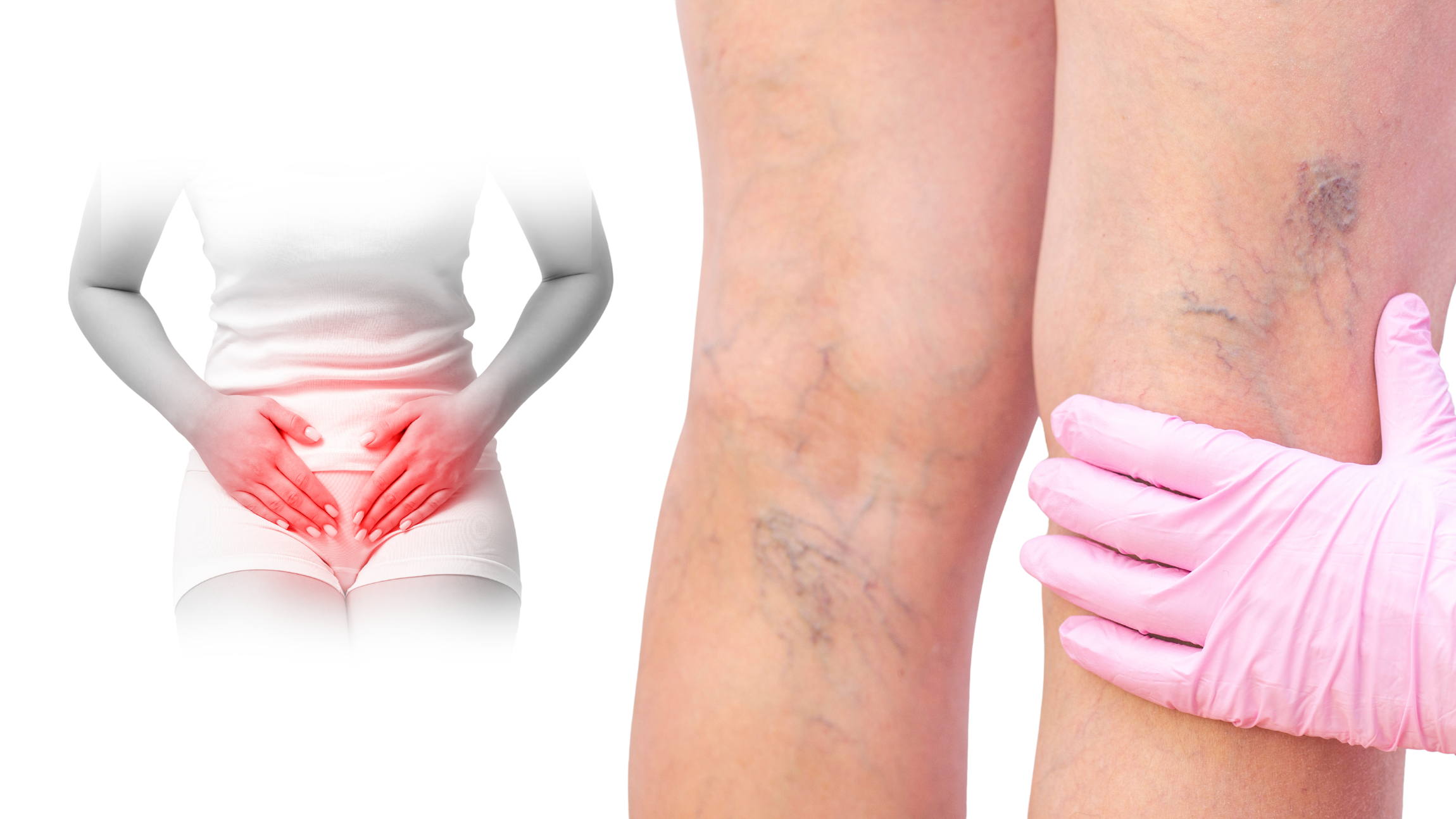 Night Cramps and Varicose Veins