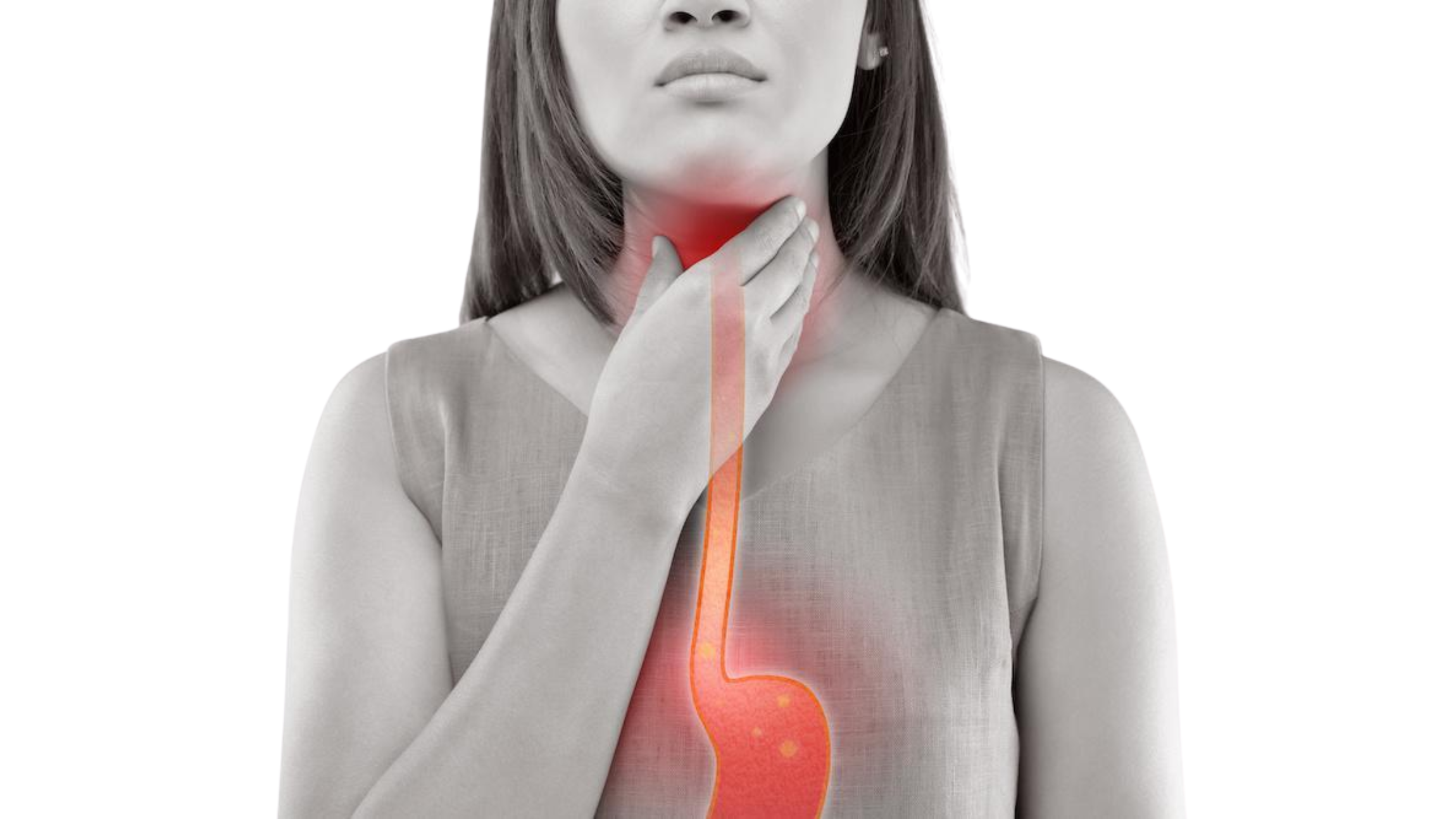 Acid Reflux