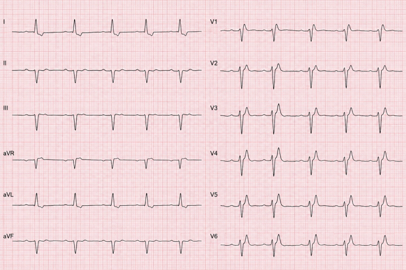 The patient's current resting 12-lead ECG.