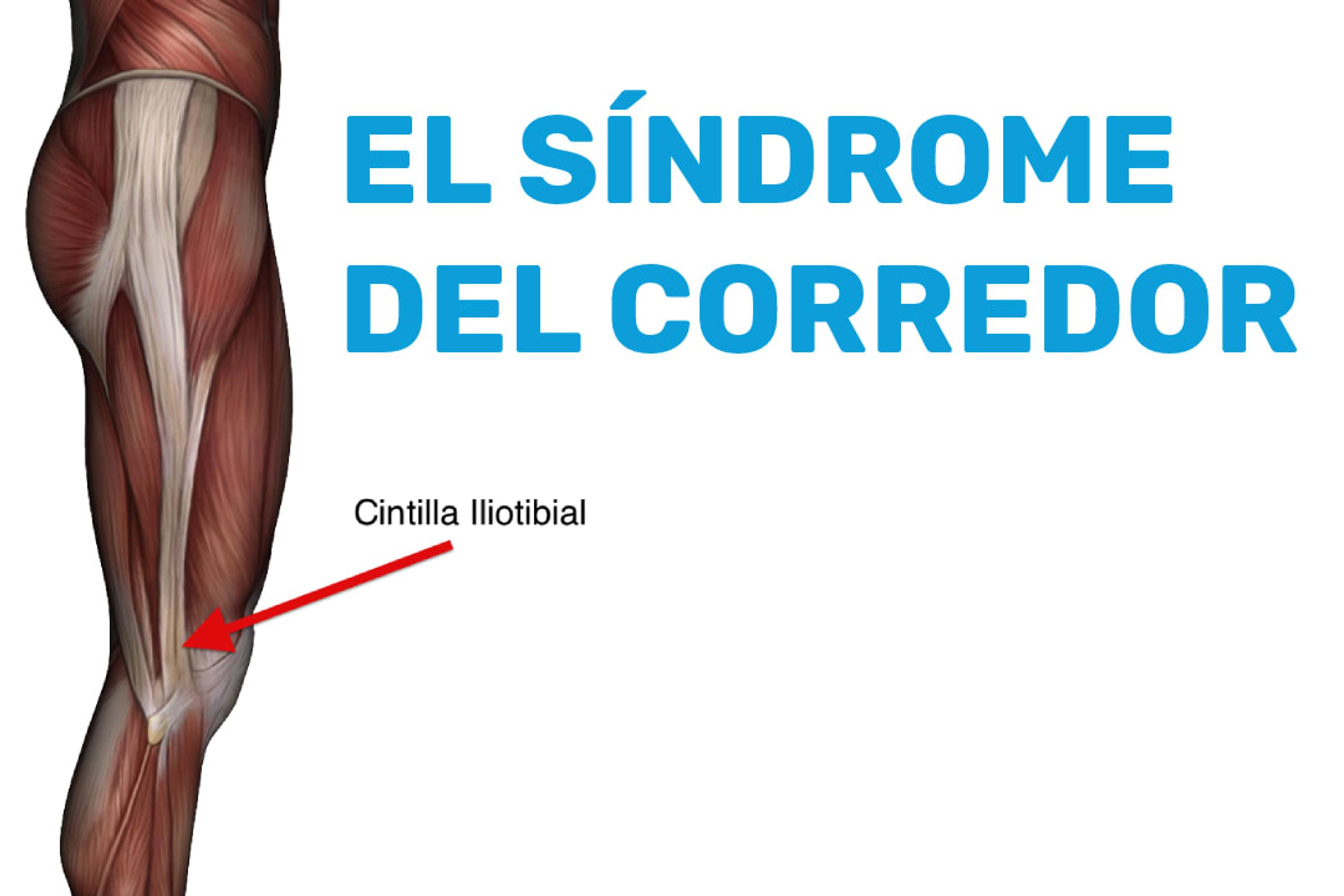 El síndrome del corredor